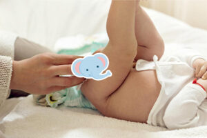 Perawatan Pasca Sunat