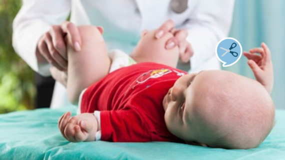 Mengenal Jenis Metode Sunat