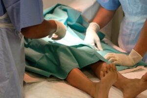 5 Manfaat Sunat untuk Kesehatan, Yang Terakhir Bisa Cegah Kanker Penis!