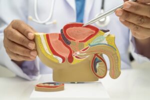 Bisakah Webbed Penis Disunat? Ini Rekomendasi Klinik Sunat Bandung untuk Penanganan yang Aman