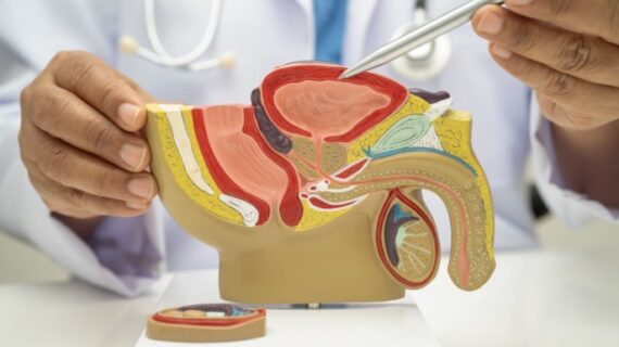 Sunat Bisa Menurunkan Risiko ISK? Percayakan pada Klinik Sunat Bandung Ini