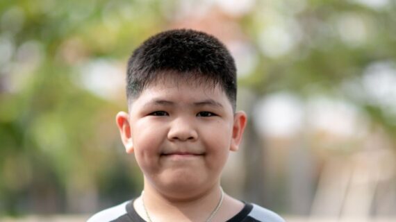 Sunat Anak Gemuk, Wajibkah Terapi Hormon Sebelum Tindakan?