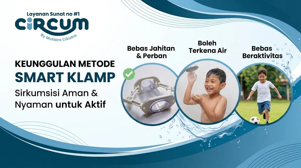 keunggulan metode sunat smart klamp cibubur bebas jahitan